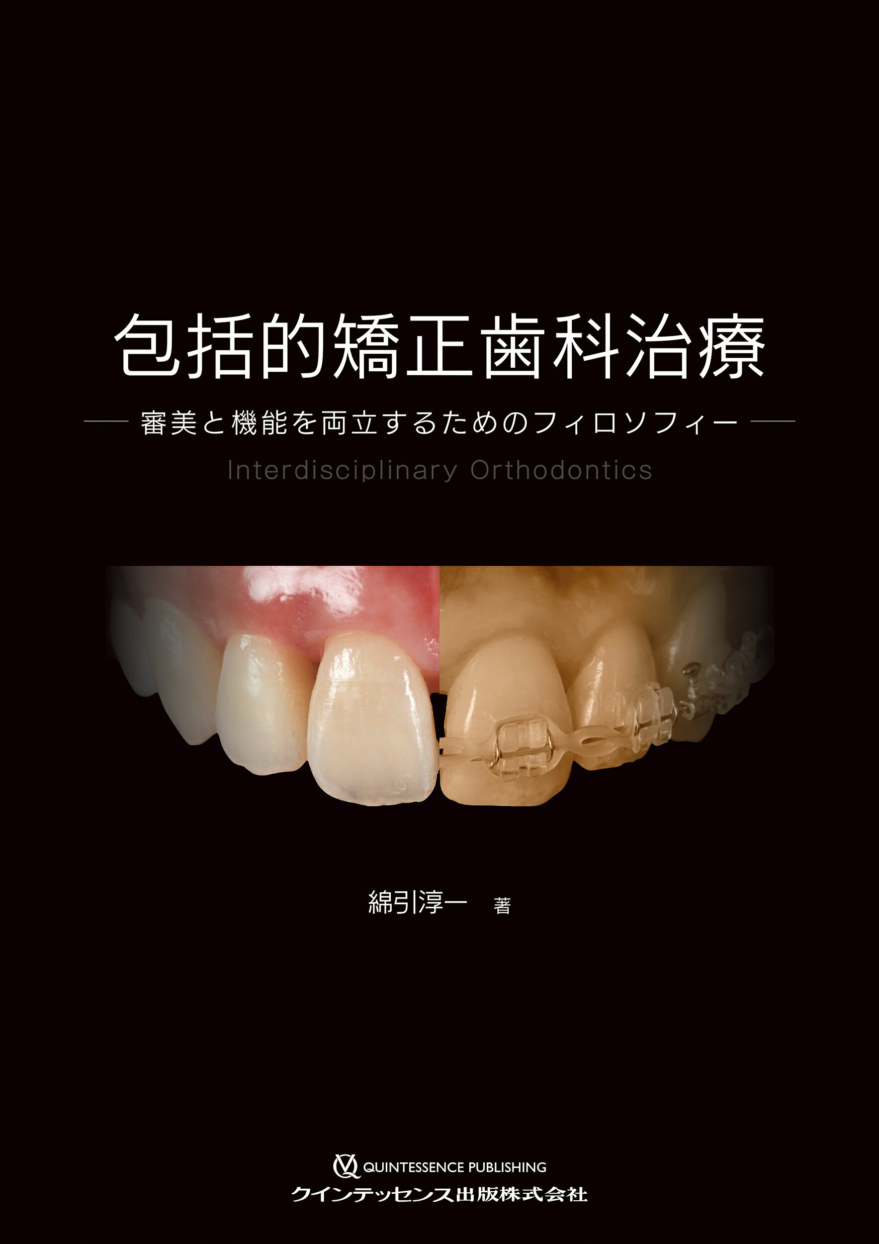 包括的矯正歯科治療 審美と機能を両立するためのフィロソフィー/クインテッセンス出版/綿引淳一
