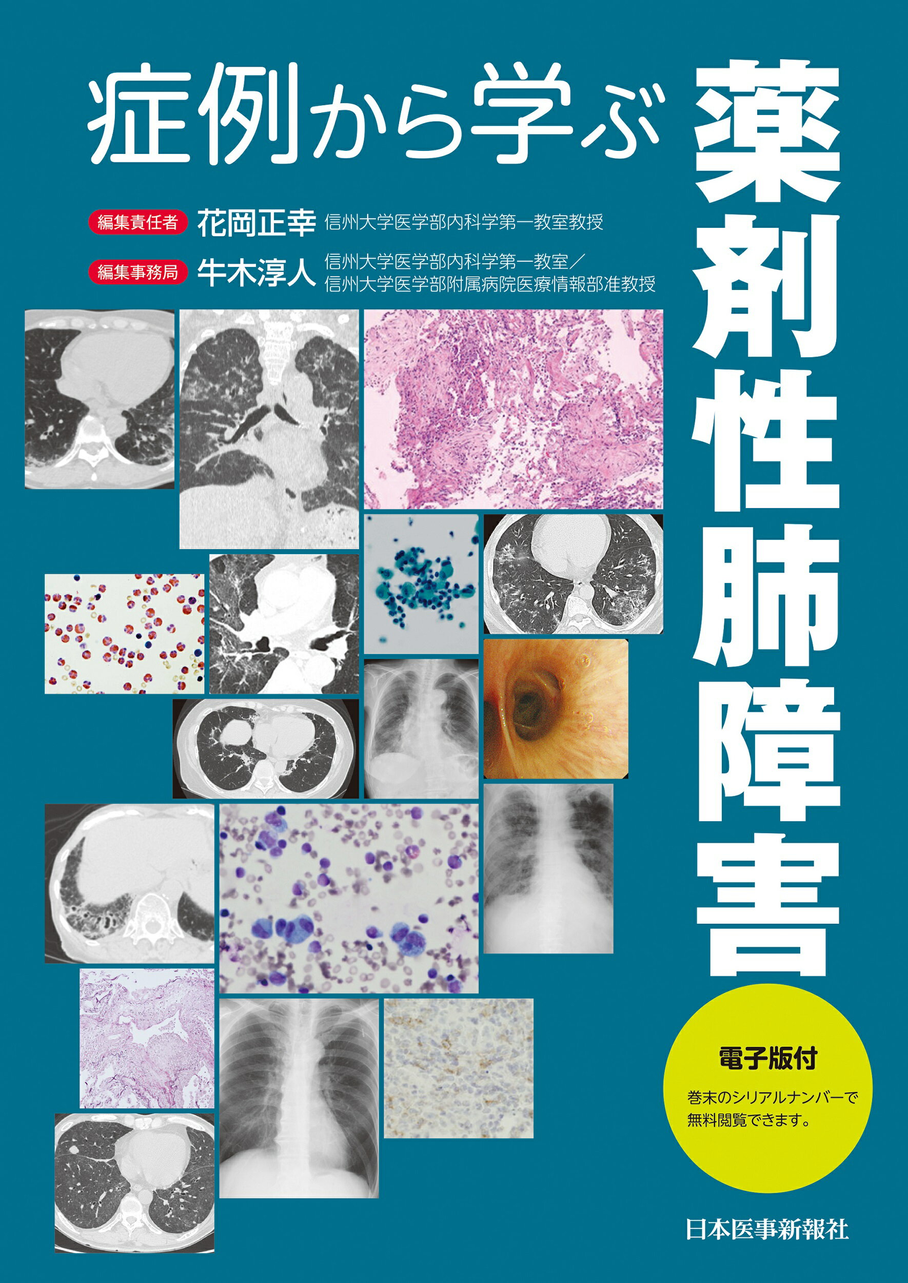 新春福袋2021 中古 間質性肺疾患とその周辺 三上 理一郎 金原出版 単行本 メール便送料無料 あす楽対応 その他 Esehotel Lt