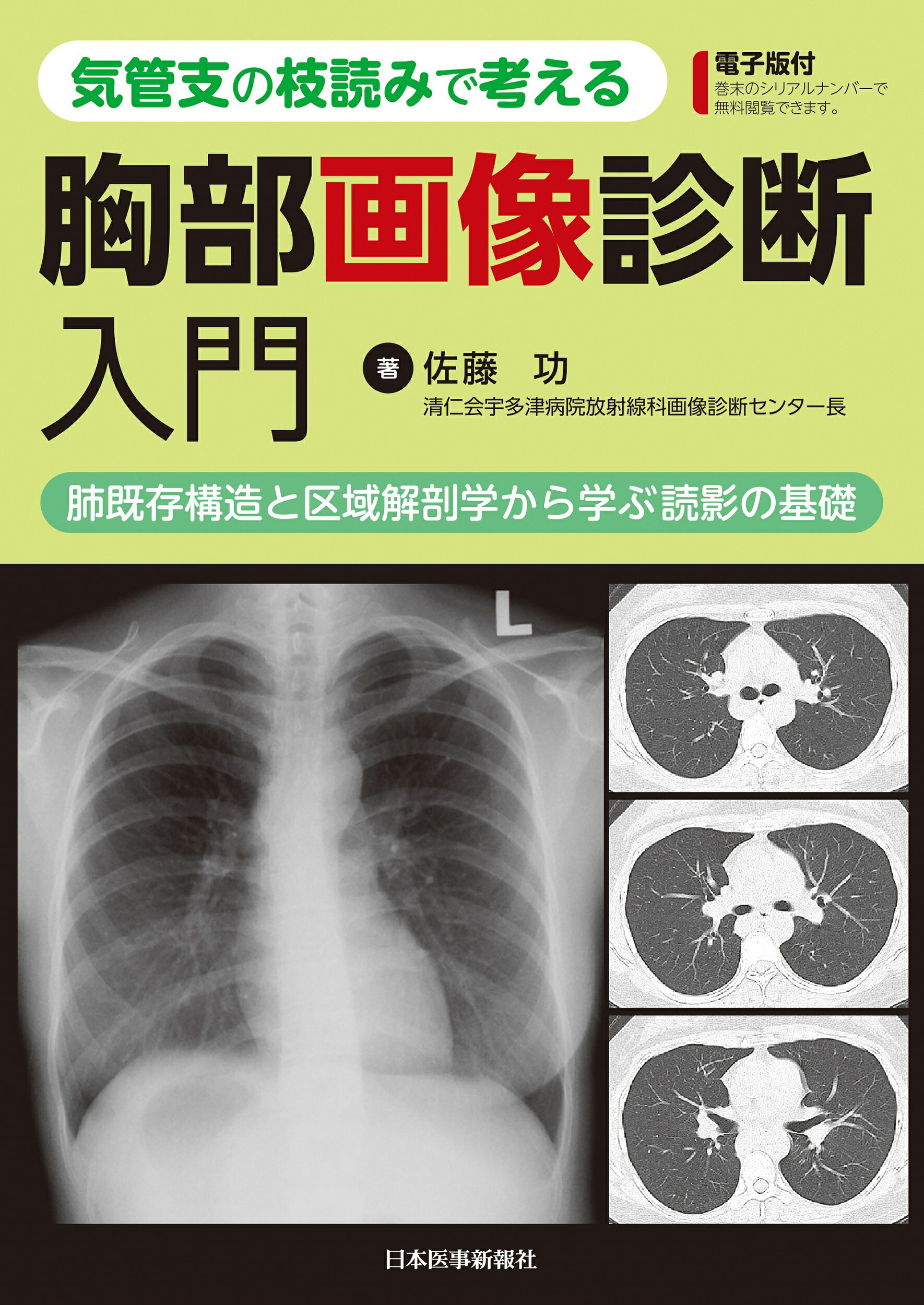 楽天市場 日本医事新報社 気管支の枝読みで考える胸部画像診断入門 肺既存構造と区域解剖学から学ぶ読影の基礎 電子版付 日本医事新報社 佐藤功 医学 価格比較 商品価格ナビ