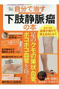 楽天市場 マキノ出版 下肢静脈瘤は自分で治せる 足の血管のコブを退治する体操と生活 マキノ出版 広川雅之 価格比較 商品価格ナビ
