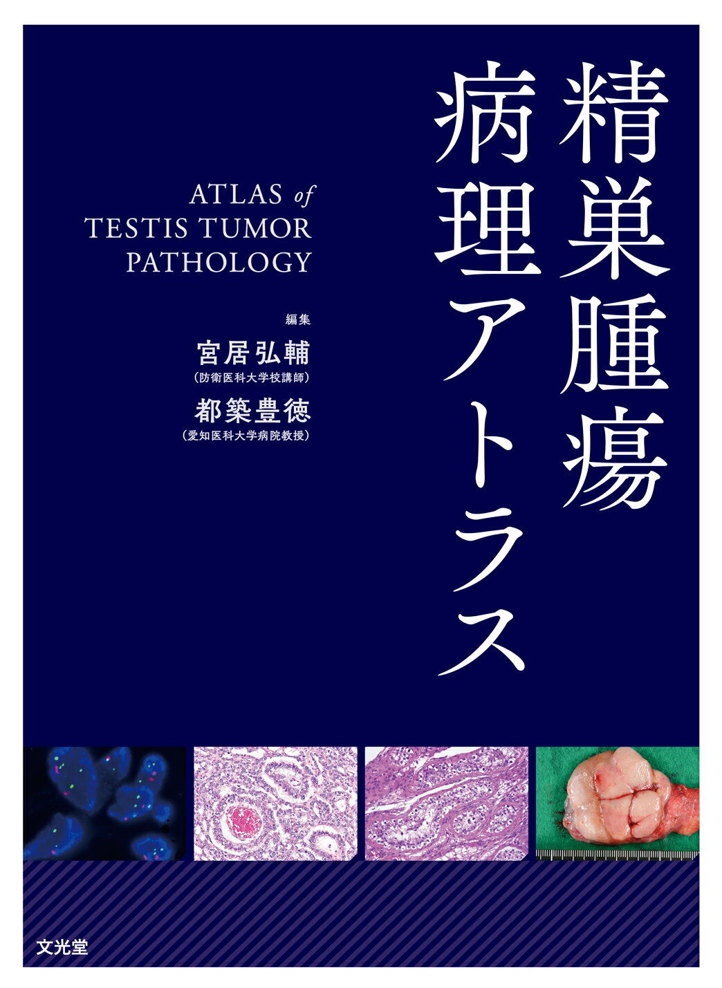 楽天市場】文光堂 精巣腫瘍病理アトラス/文光堂/宮居弘輔 | 価格比較