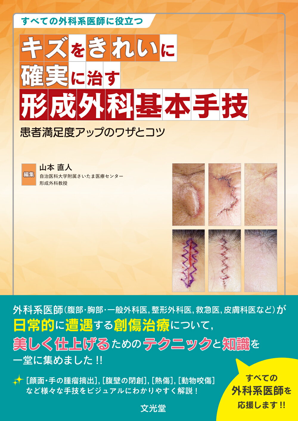 日本最大の本スキル外来手術アトラス : すべての外科系医師に必要な美しく治すための基本手技
