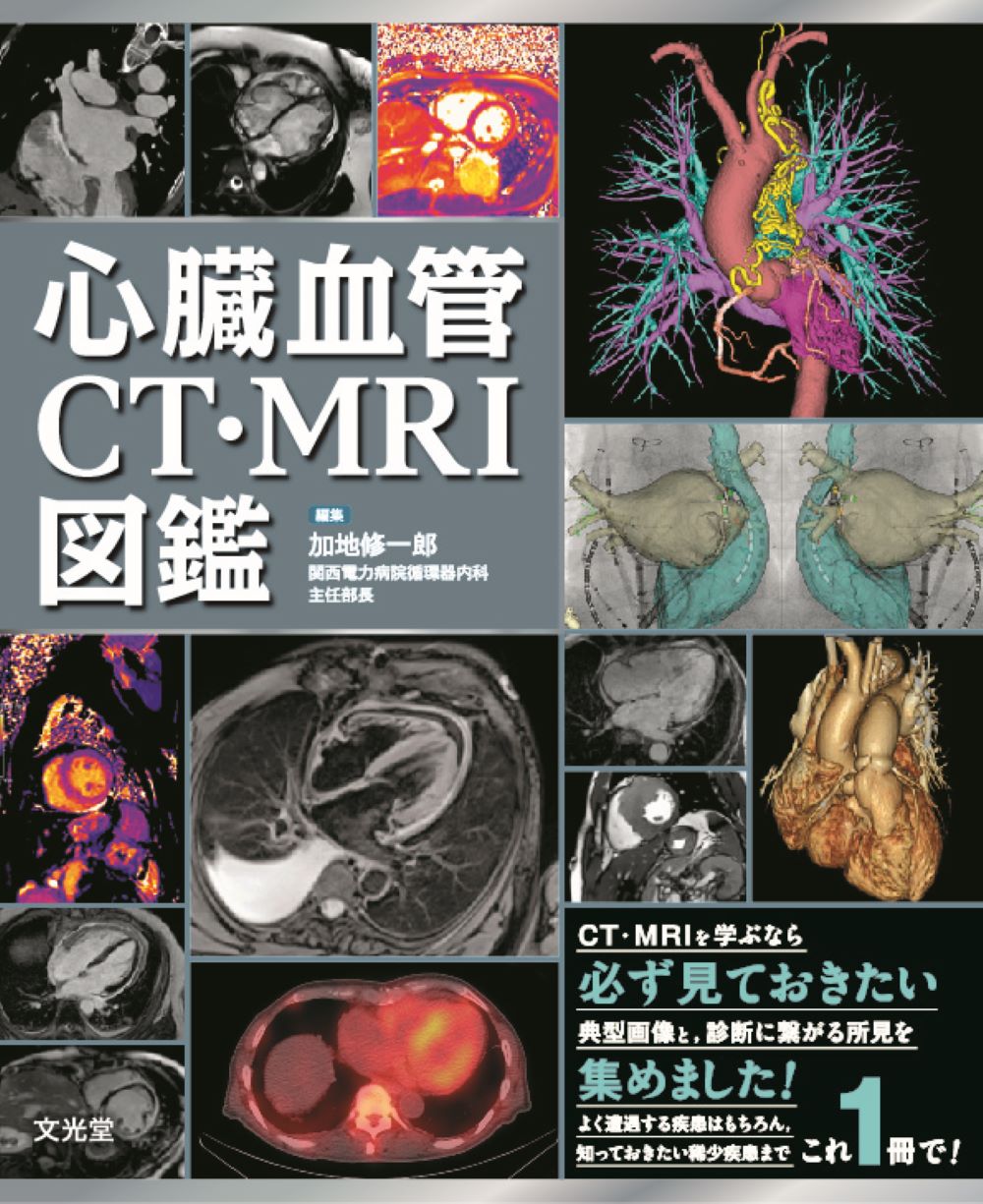 楽天市場】文光堂 心臓血管CT・MRI図鑑/文光堂/加地修一郎