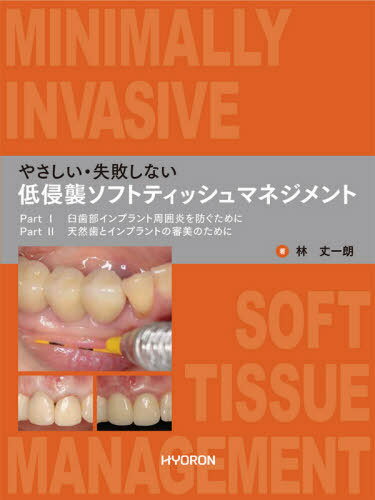 やさしい・失敗しない低侵襲ソフトティッシュマネジメント Ｐａｒｔ１：臼歯部インプラント周囲炎を防ぐために／/ヒョ-ロン・パブリッシャ-ズ/林丈一朗