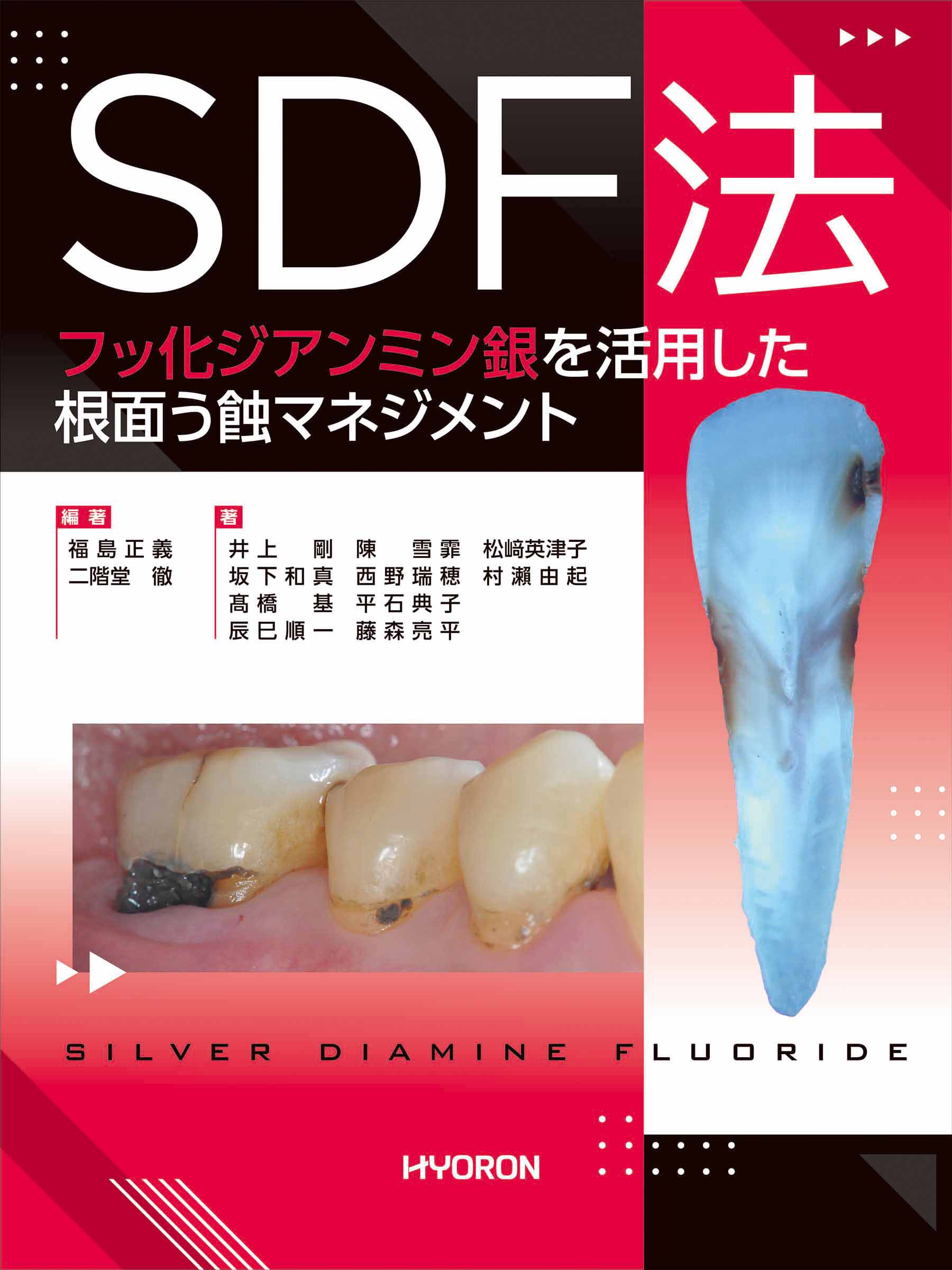 MORPHOLOGY 歯牙形態の類似性　歯科　歯科技工 MORPHOLOGY 歯牙形態の類似性 歯科 歯科技工