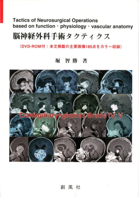 楽天市場】創風社 難治性てんかんの治療/創風社/堀智勝 | 価格