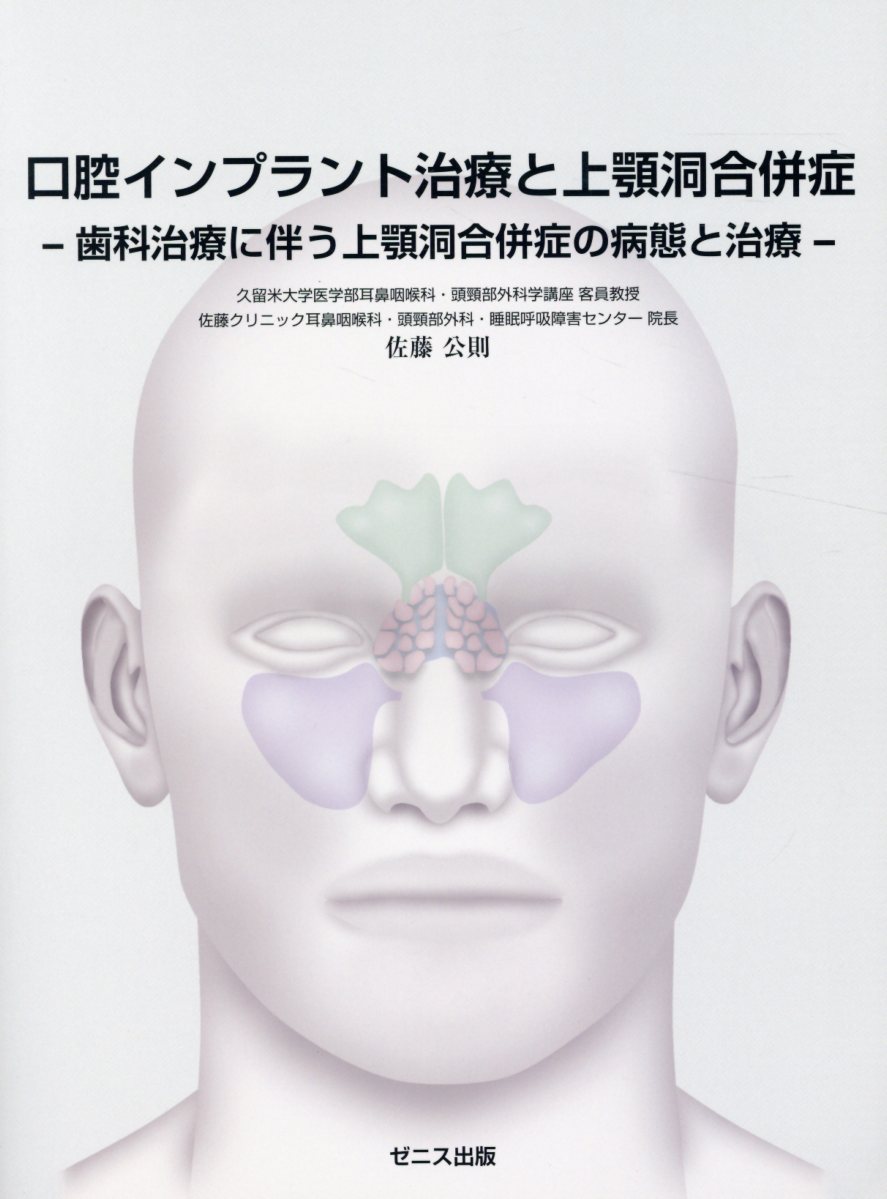 楽天市場 ゼニス出版 口腔インプラント治療と上顎洞合併症 歯科治療に伴う上顎洞合併症の病態と治療 ゼニス出版 佐藤公則 価格比較 商品価格ナビ