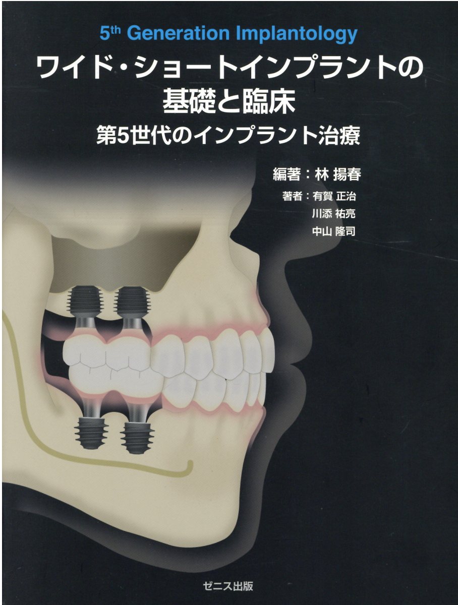 楽天市場】デンタルダイヤモンド社 インプラントの撤去～リスク診断