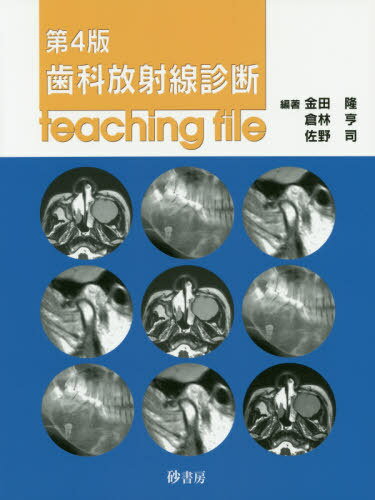 楽天市場】砂書房 歯科放射線診断ｔｅａｃｈｉｎｇ ｆｉｌｅ 第４版/砂書房/金田隆 | 価格比較 - 商品価格ナビ