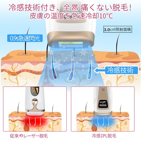 TOPRED 脱毛器 楽天市場】TOPRED IPL光脱毛器 白 | 価格比較 - 商品価格ナビ