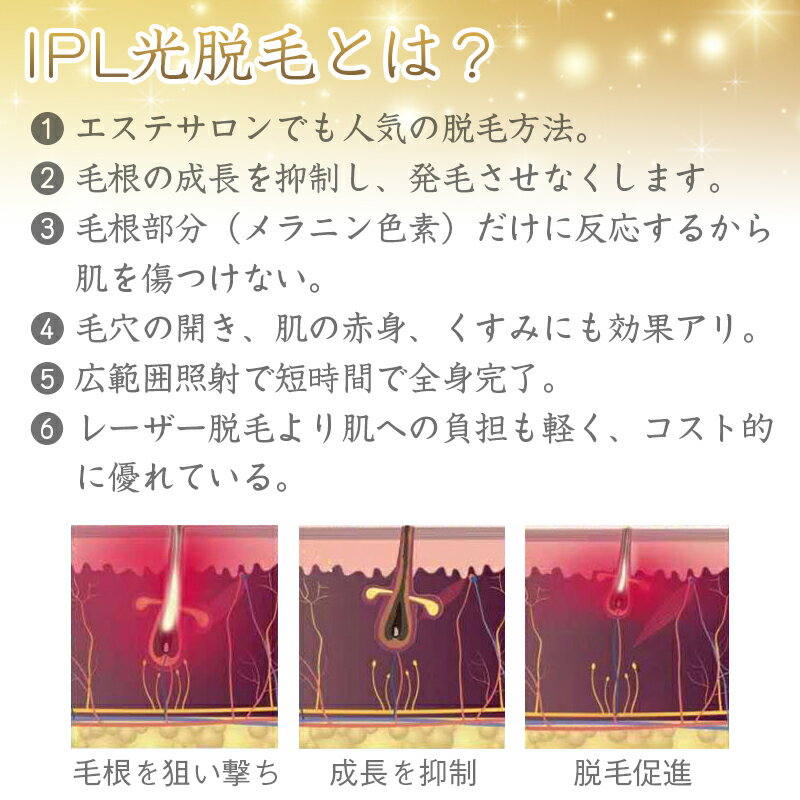 IPL光冷却脱毛 フラッシュ脱毛 Hikari