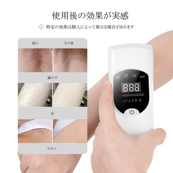 楽天市場】Entil IPL脱毛器 M2 | 価格比較 - 商品価格ナビ